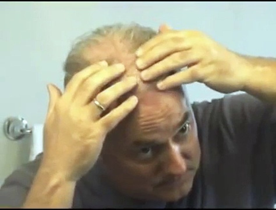 DermMatch Malaysia Hair Loss Concealer