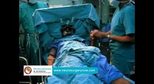 Deep Brain Stimulation Surgery in Hyderabad