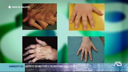 OASI DI SALUTE - 22-12-2014 (A3Replay)