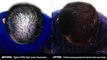 Rx 4 Hair Loss Natural and Organic  Conditioner for Men and Women