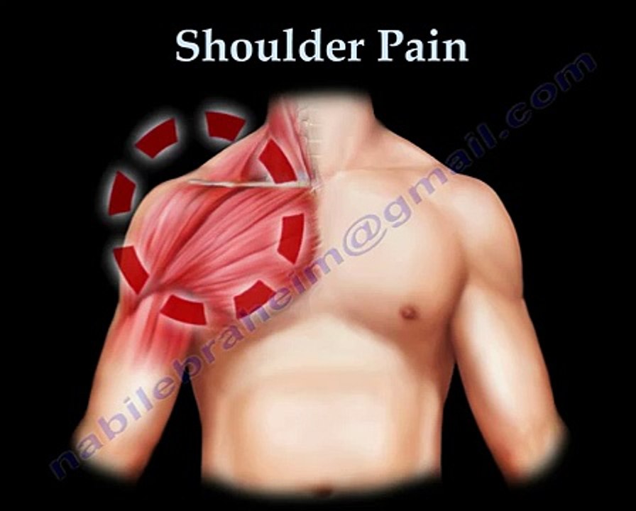 shoulder pain. FULL HD VEDIO