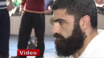 Protez Bacakla Hayatı Sırtlıyor