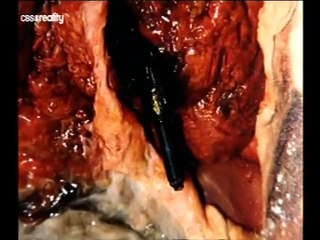 Forenzní vyšetřovatelé - Výstřední podivín vraždí pomocí luku a šípů