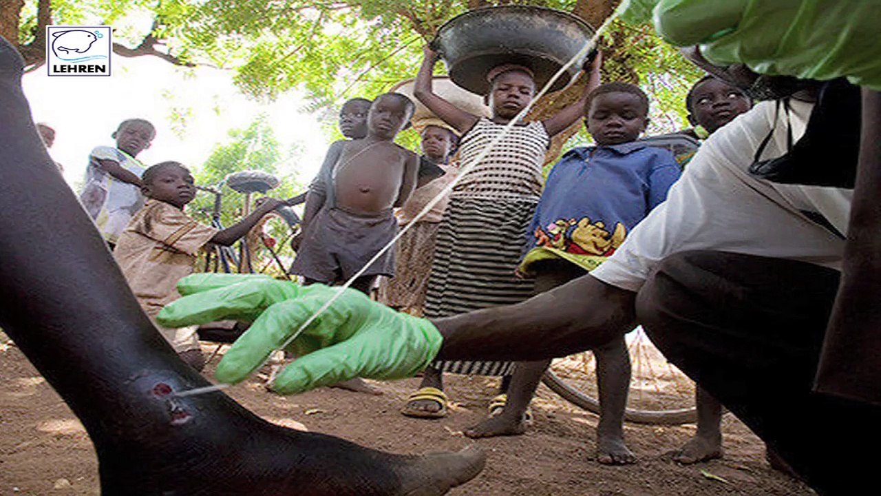 Parasitic Worm Inside A Man's Foot?