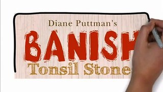 Banish Tonsil Stones VSL