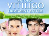 ★ Natural Vitiligo Treatment System  ► Cure Your Vitiligo Naturally, Safely and Permanently ★