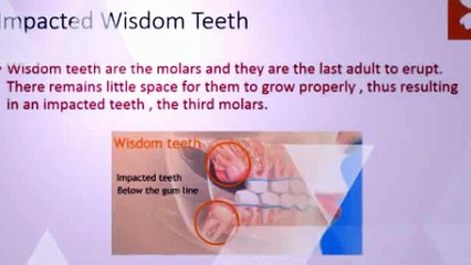 Consequences of Wisdom Teeth - Cedar Dental Care