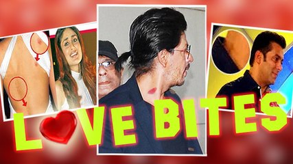 Bollywood Celebs CAUGHT With Love Bites