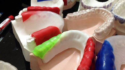 Types Of Colored Dental Sports Guards Part-II