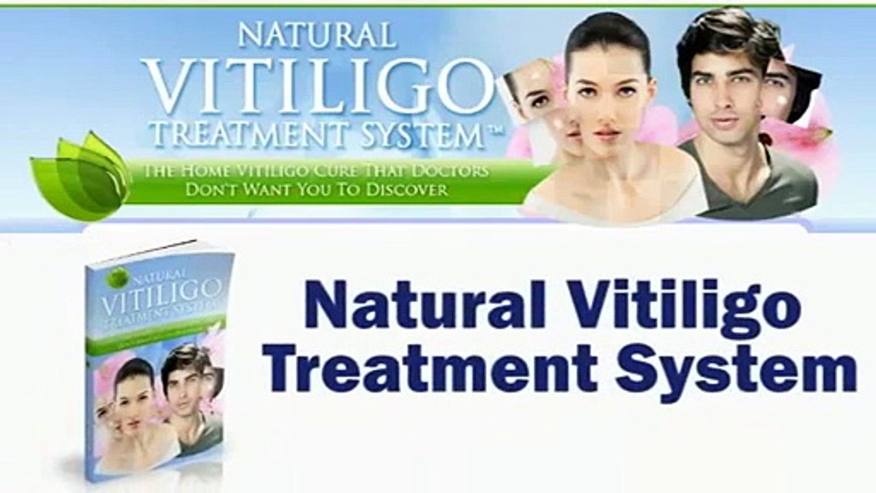 Natural Vitiligo Treatment System Review - Watch This Before You Buy