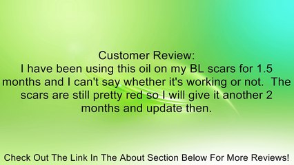 Pura d'or Scar Treatment Solution (2 fl. oz.) Review