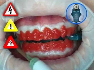 PËR NJË,  BUZËQESHJE PERFEKTE