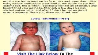 Eczema Free Forever Don't Buy Unitl You Watch This Bonus + Discount