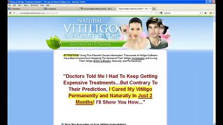 Natural Vitiligo Treatment System Bonus Offer