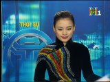 Tháng Hành Động Chống Ung Thư Vú Tại BVUB Hưng Việt - HTV