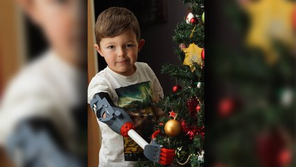 New Arm For Christmas: 5-year-old Opens Presents With Limb Made From 3D Printer
