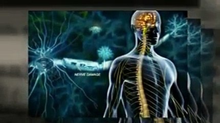 A Natural Multiple Sclerosis Cure
