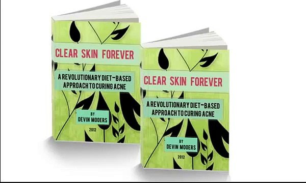 oily skin acne natural treatment - Clear Skin Forever
