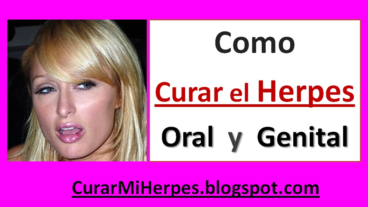 Como Se Cura el Herpes Genital Femenino y Masculin