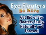 ★ Eye Floaters No More ► Discover How to Get Rid Of Eye Floaters Easily, Naturally and Forever ★