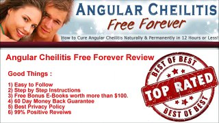 Angular Cheilitis Free Forever Review -- Pros & Cons