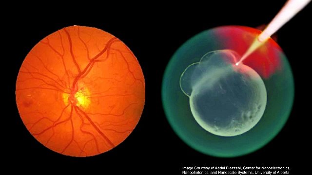 Catherine Mohr: How Nanotechnology Kills Cancer Cells