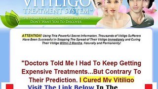 Natural Vitiligo Treatment System FACTS REVEALED Bonus + Discount