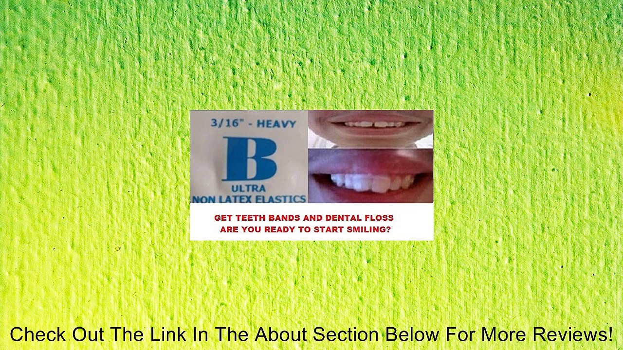 ORTHODONTIC GAP TEETH BANDS 3/16 HEAVY 100 BANDS Review video Dailymotion
