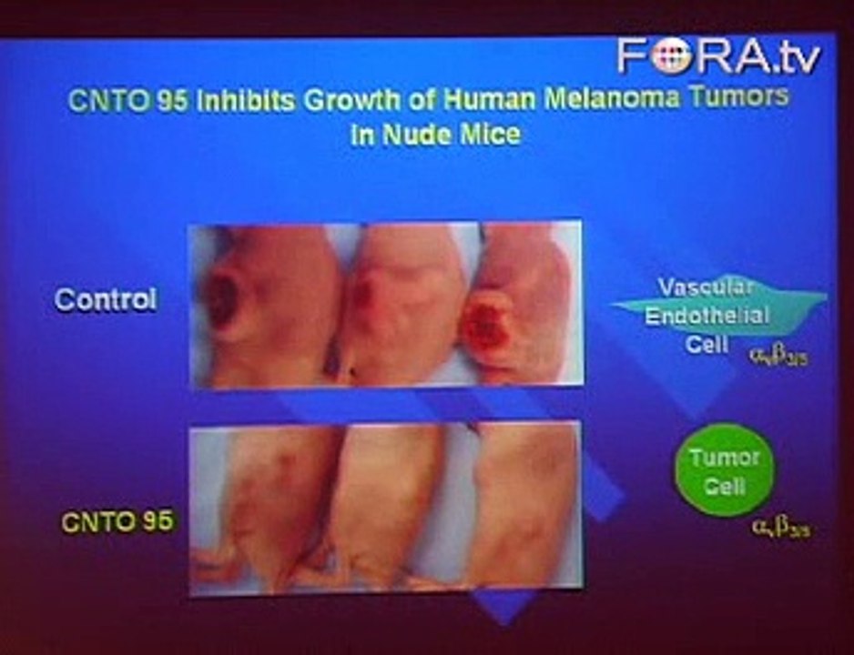 Anna Pavlick on New Skin Cancer Treatment Drugs