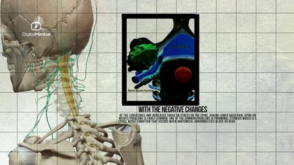 MUST SEE! High Heels - its HARMFUL EFFECTS to the BODY