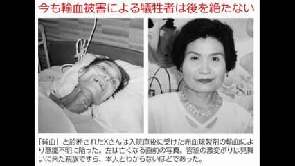 ガン患者を悪化させる輸血製剤　