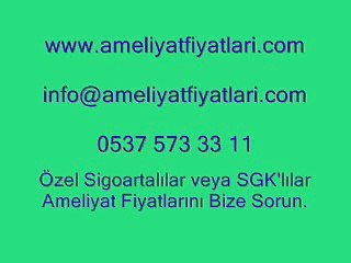 Download Video: horlama ameliyatı, horlama, 0537 573 33 11, horlama ameliyatı fiyatı, horlama ameliyatı videosu, horlama ameliyatı nasıl yapılır,