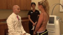 CoolSculpting of Bra Roll Fat and Upper Back Fat in Connecticut at Jandali Plastic Surgery