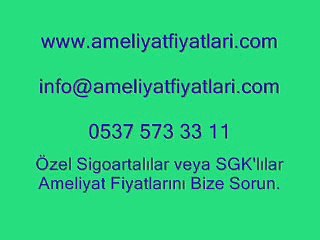 yüz germe ameliyatı fiyatları, 0537 573 33 11, yüz germe estetiği fiyatları, yüz estetik,