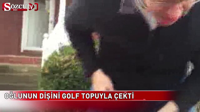 Böyle diş çekimi yöntemi görülmedi