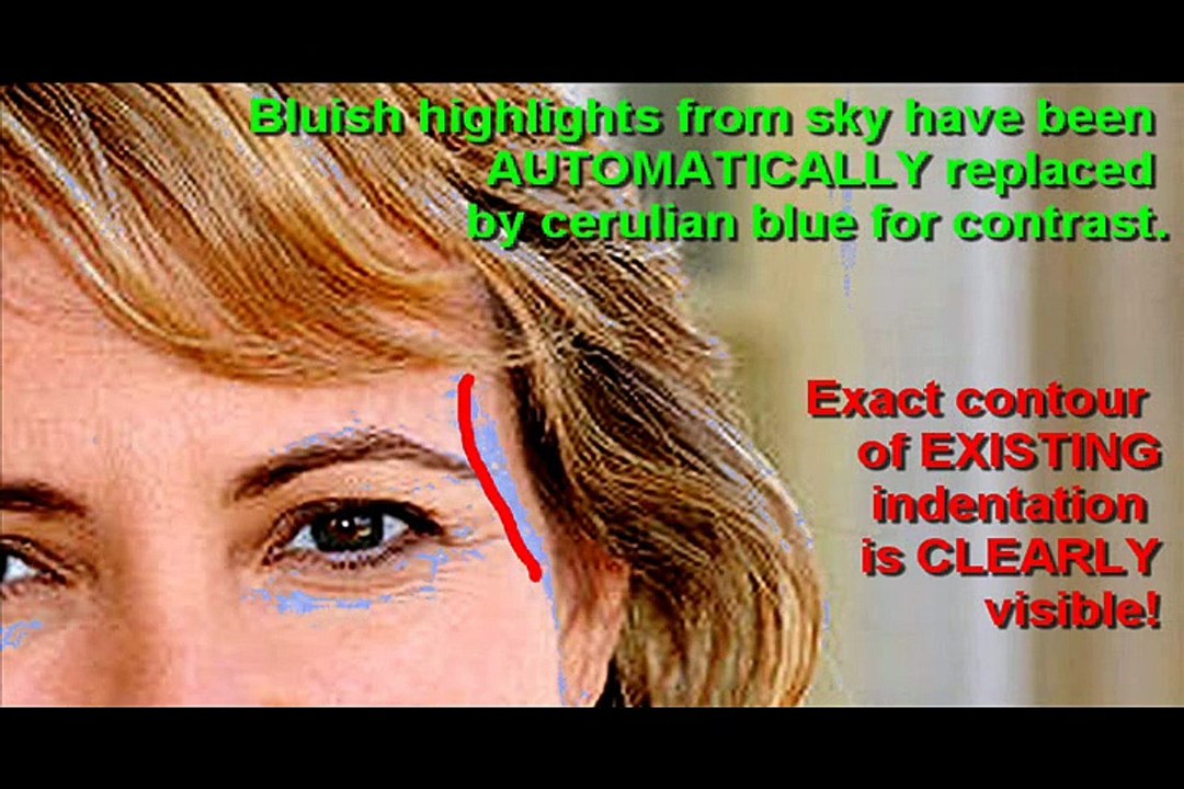 The Giffords "Shooting" FAKE - Her 'Miracle Head Wound' - Anniversary Special I