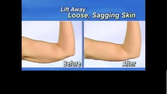 Lift Kol Sarkmalarına Karşı Gizleyici Bant indirimsmart.com