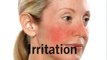 Reduce Redness & Irritation - Rosacea Treatment - Rodan and Fields - Soothe (skinproductsdirect.com)
