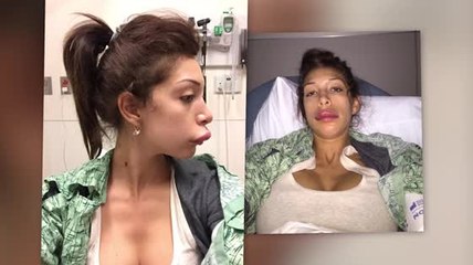 Farrah Abraham's Lip Injections Go Horribly Wrong