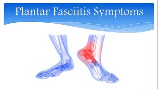 Treatment For Plantar Fasciitis - How To Heal Plantar Fasciitis, Foot Plantar Fasciitis