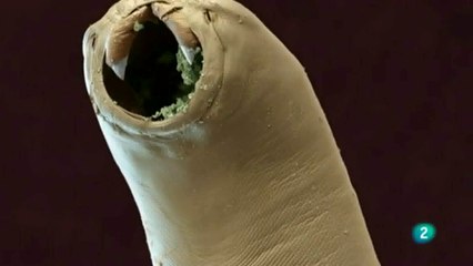 Alergias y parasitos: Hipotesis de los viejos amigos