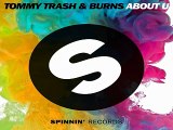 [ DOWNLOAD MP3 ] Tommy Trash &  Burns - About U (Original Mix)