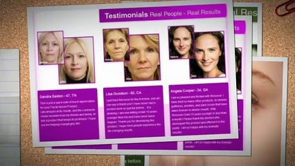 there unit many lines around my eyes