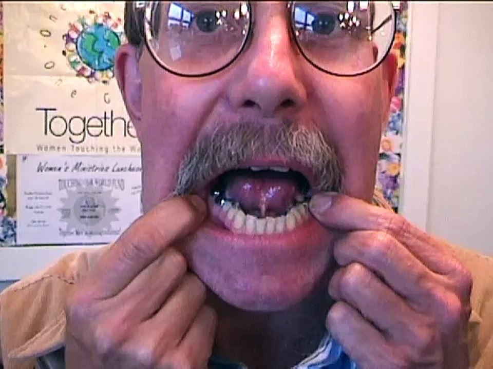 God's Recent Miracles #4 (Dental Miracles)