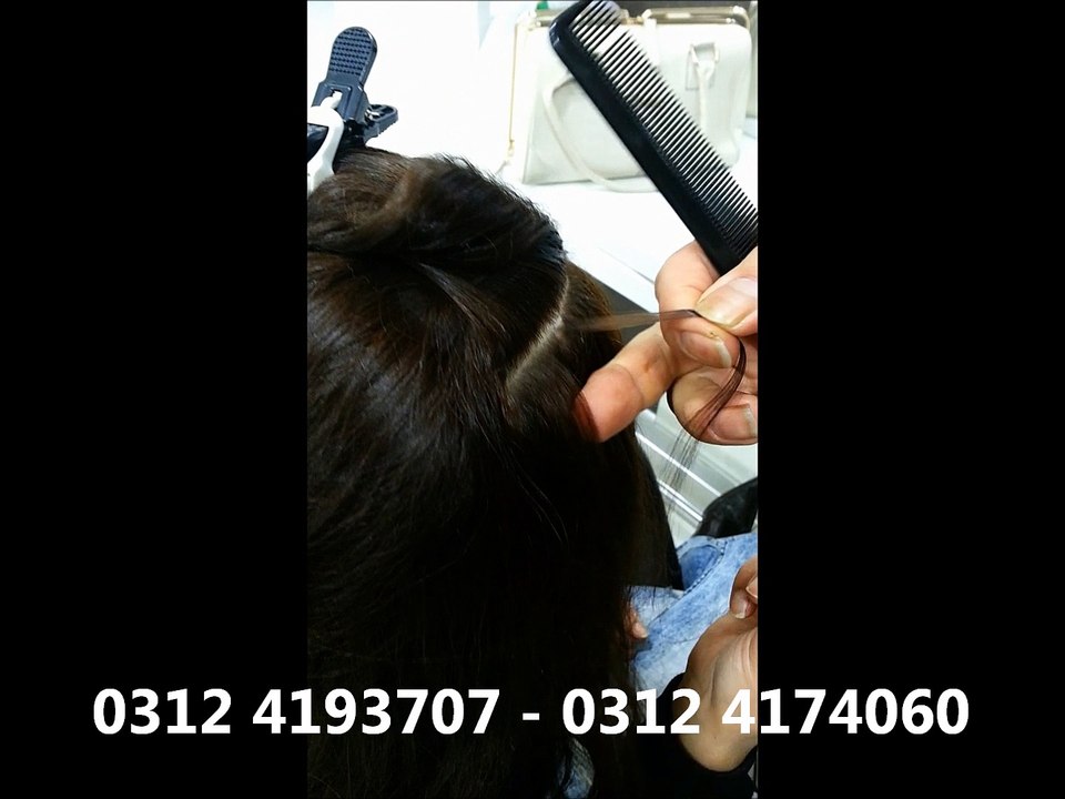 PRENSES MİKRO KAYNAK - HEMEN RANDEVU ALIN 0312 4193707