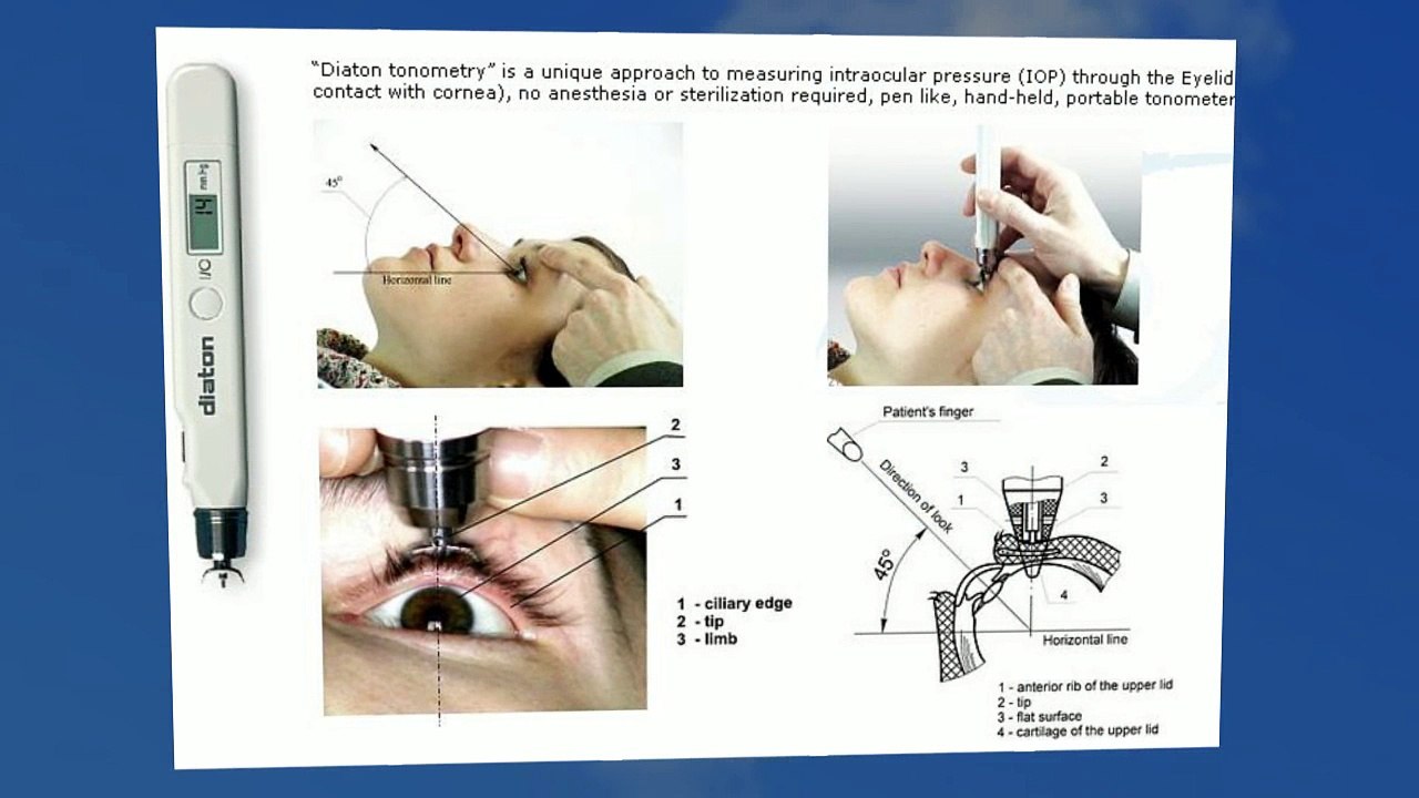 Tonometer