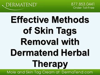 Effective Methods of Skin Tags Removal with Dermatend Herbal Therapy