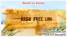 Banish my Bumps Review and Risk Free Access (GET IT NOW)