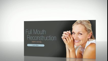 Dental Implants Farmington Utah