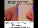 Special & Advanced plastic surgery, conducted  by Dr Mohammed Faig Abad Alrazak